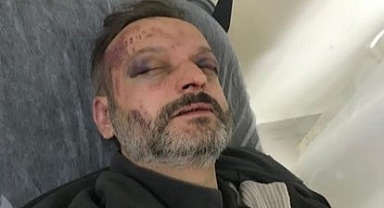 İstedikleri parça geç çalındığı için müzisyeni öldüresiye dövdüler 